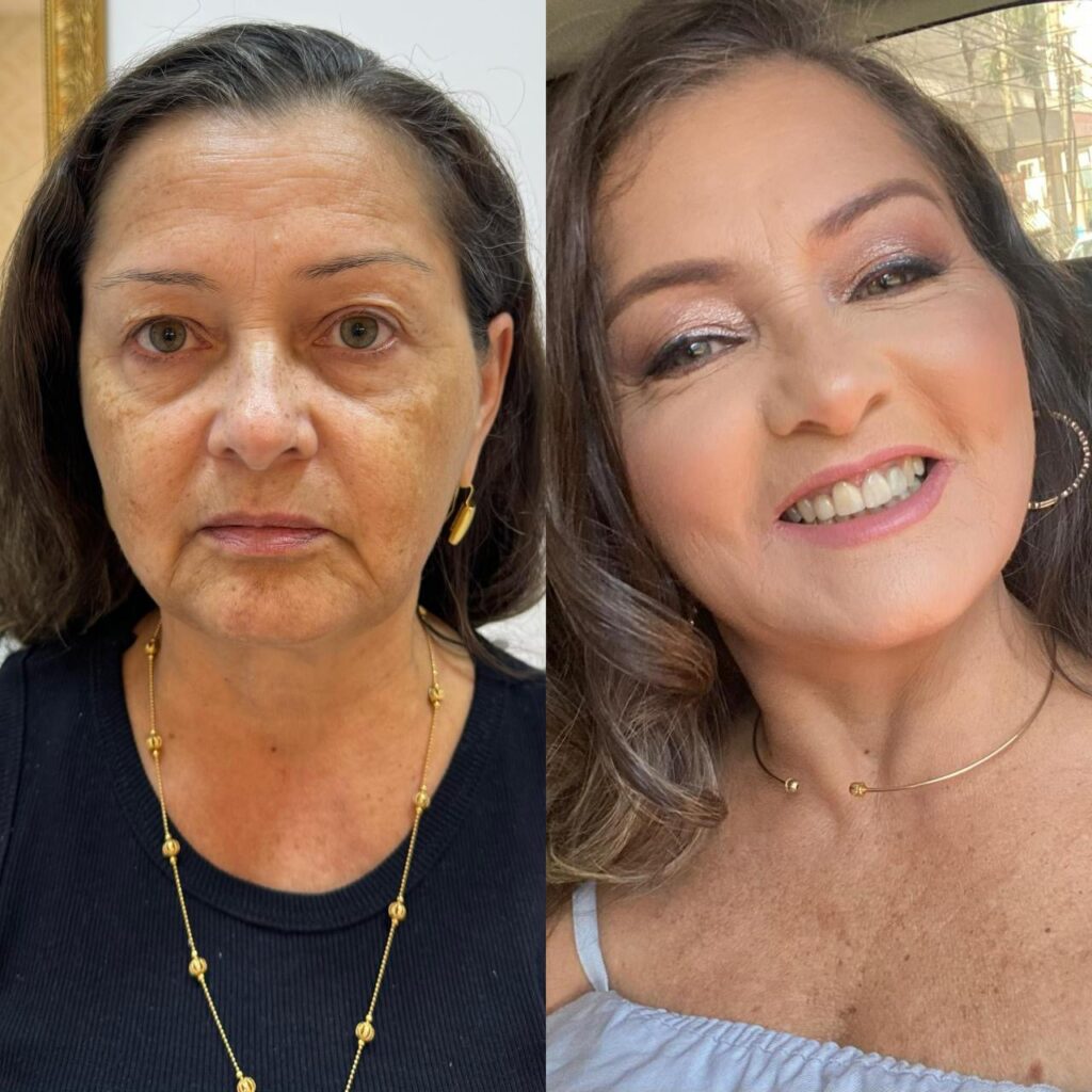 Dra Laura Tavares Consolida Clínica Como Referência Em Estética Avançada Em Brasília 2 378d7935 d3ce 426d 8cbb 7e514fb95590