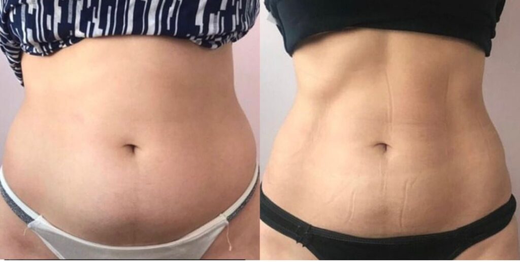 469292ba 72da 422e 8493 6bac03d6f379