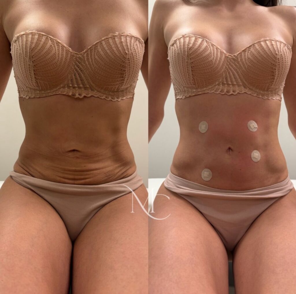 a8452f9e 22a8 4670 8d89 5a8a9d788a63