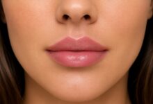Labios