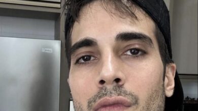 Fiuk Mostra Novo Visual Após Harmonização Facial 3 IMG 2852